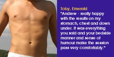 Emerald IPL Hair Removal review